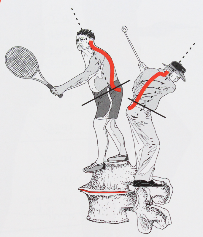 Hohlkreuz bei Tennisspieler und Golfspieler mit falscher Körperhaltung können Probleme bereiten. Poschmerzen